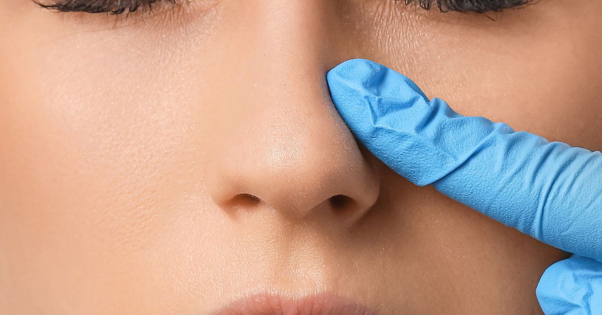 Nose Surgery .jpgabe - Dr. Muddappa P. P. Blog